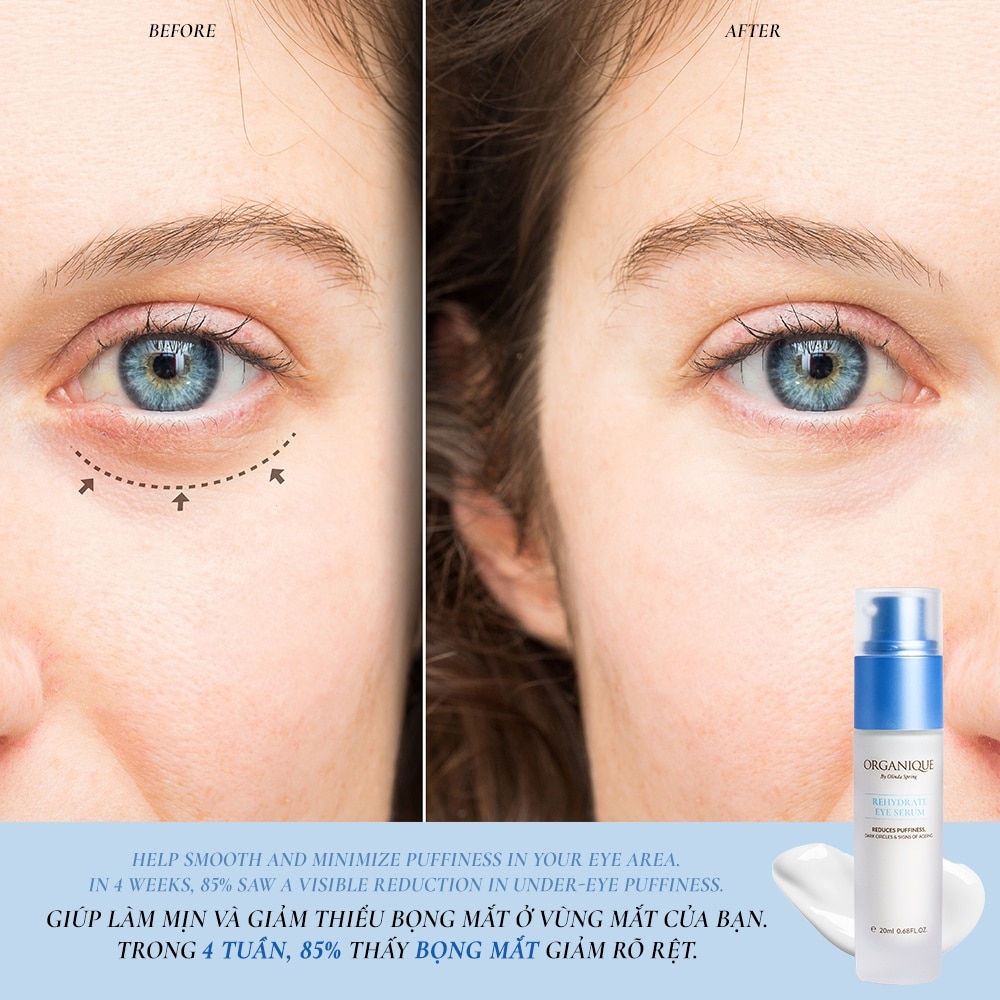Kem Vùng Mắt Organique Dưỡng Ẩm Rehydrate Eye Serum 20ml