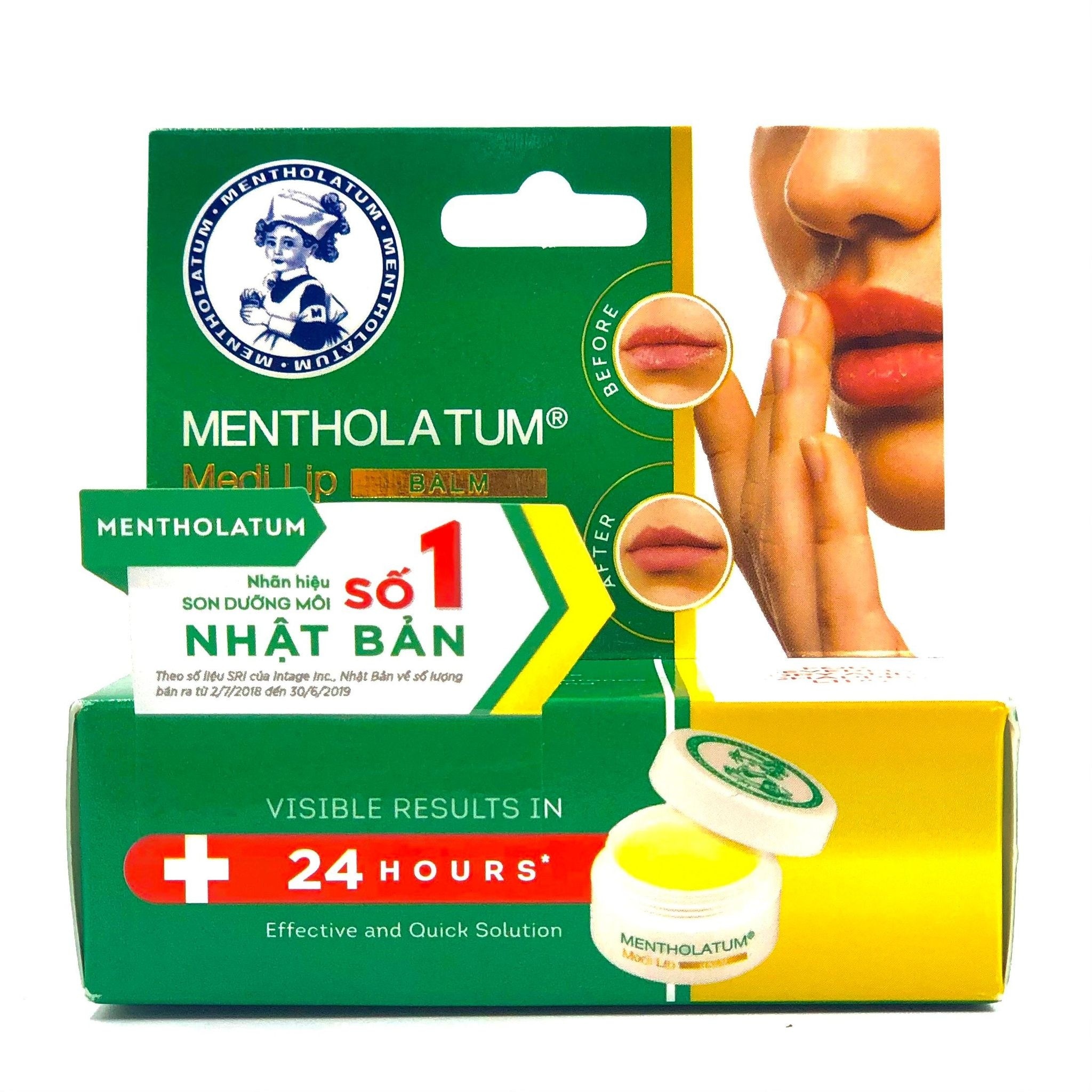 Son Dưỡng Mentholatum Medi Lip Balm Dành Cho Môi Khô Và Nứt Nẻ 7g