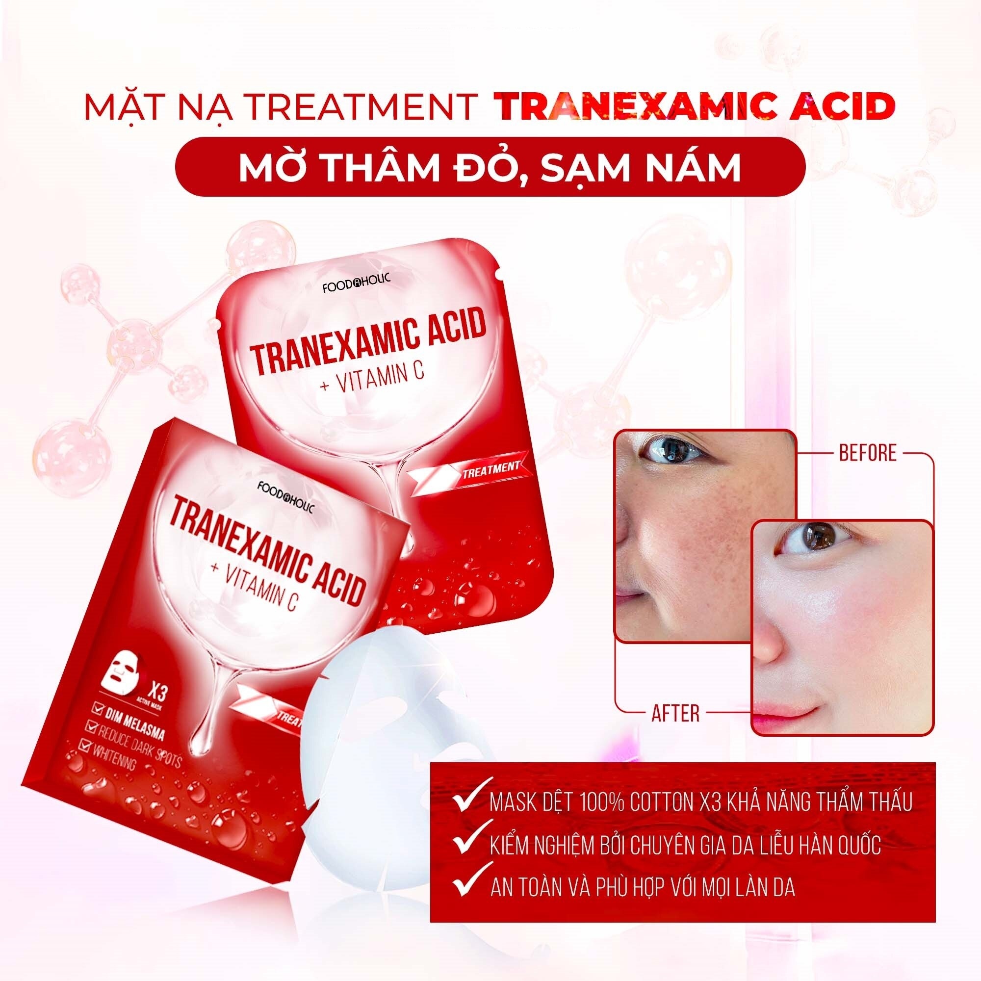 Mặt Nạ Foodaholic Tranexamic Acid Mờ Thâm Đỏ, Sạm Nám Tranexamic Acid Ample Mask 23ml