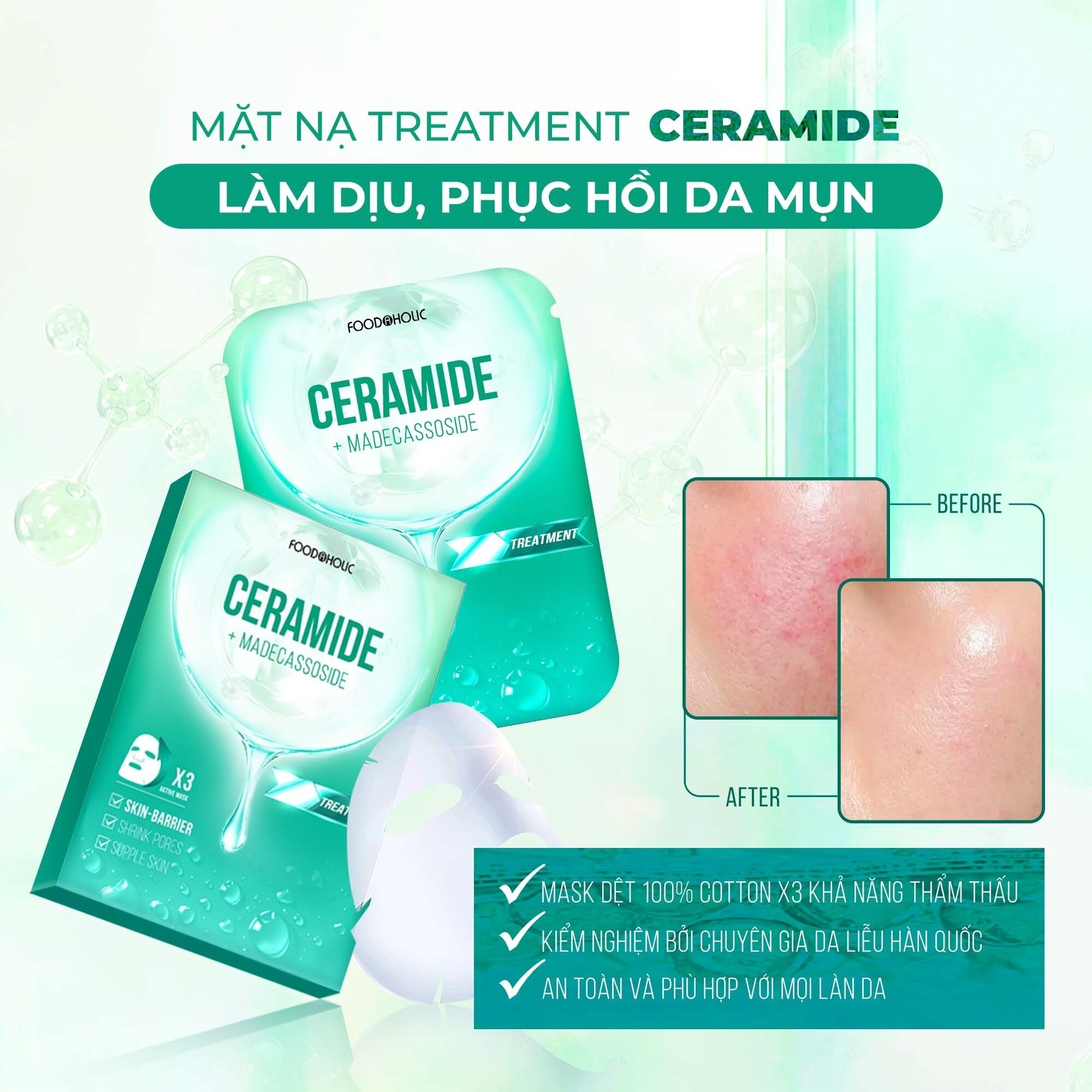 Mặt Nạ Foodaholic Ceramide Làm Dịu, Phục Hồi Da Mụn Ceramide Ample Mask 23ml