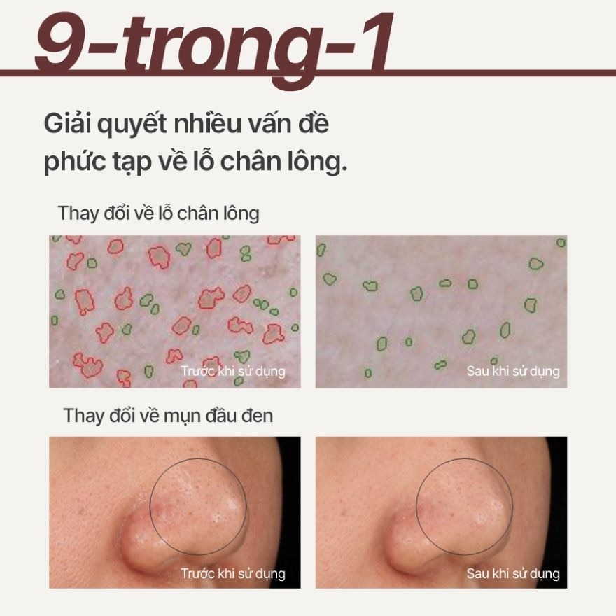 Super Volcanic Pore Clay Mask 100ml