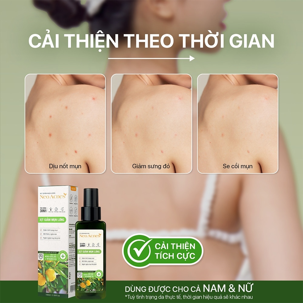 Xịt Giảm Mụn Lưng Neoskin Neo Acnes 100ml image